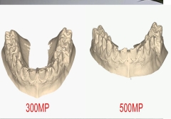 Qscan  max skaner dentystyczny