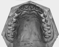 Qscan 2.6m skaner dentystyczny
